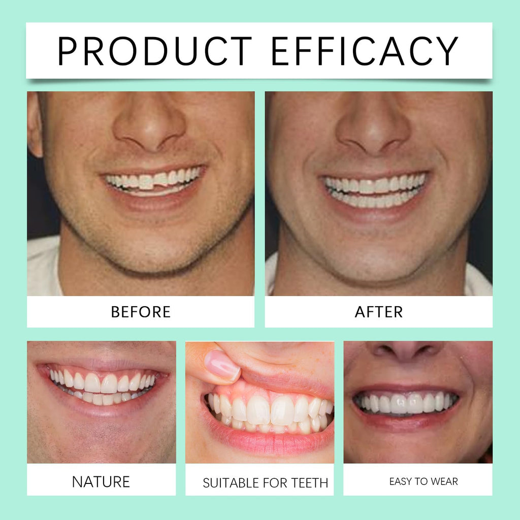 Soft Denture Silicone Veneers, Upper and Lower Denture Set Q788003